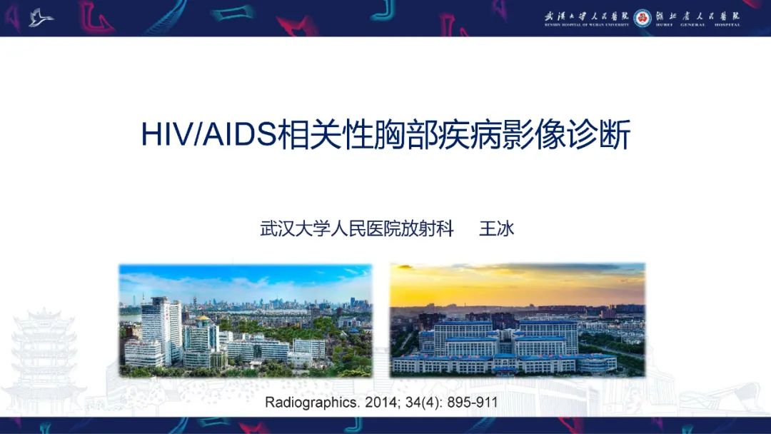 影像PPT - 【PPT】HIV/AIDS相关性胸部疾病影像诊断-1