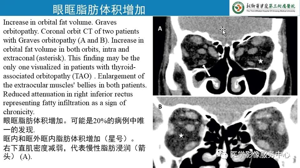 影像PPT - 【PPT】甲状腺免疫相关眼病-8