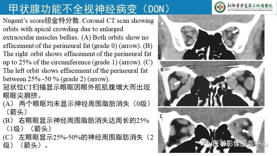 影像PPT - 【PPT】甲状腺免疫相关眼病-22