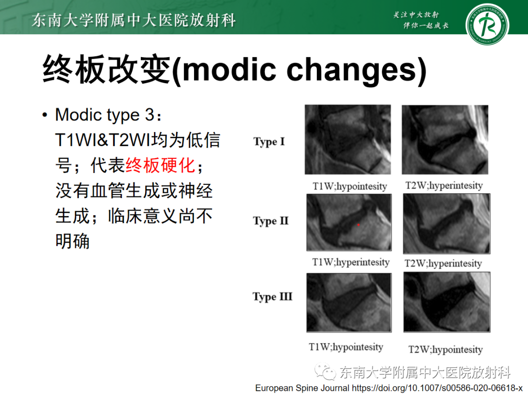 影像PPT - 【PPT】腰椎椎间盘突出/游离的影像诊断-17 影像PPT - 【PPT】腰椎椎间盘突出/游离的影像诊断-17