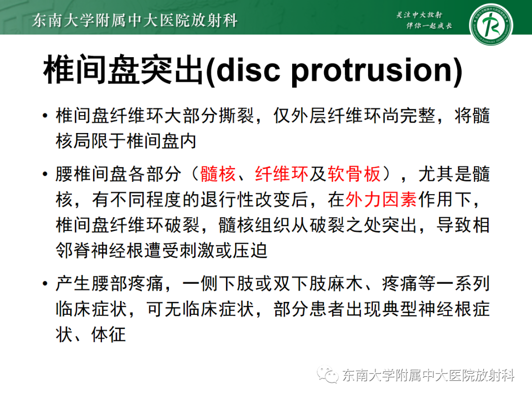影像PPT - 【PPT】腰椎椎间盘突出/游离的影像诊断-20 影像PPT - 【PPT】腰椎椎间盘突出/游离的影像诊断-20