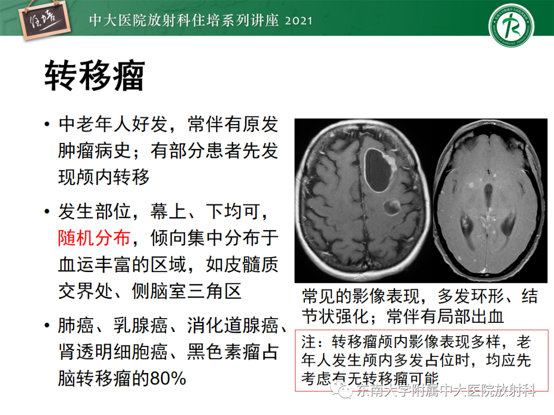 影像PPT - 【PPT】颅内多发占位的影像诊断-5