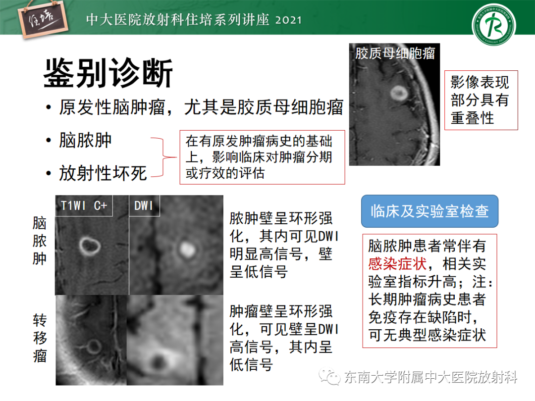 影像PPT - 【PPT】颅内多发占位的影像诊断-6