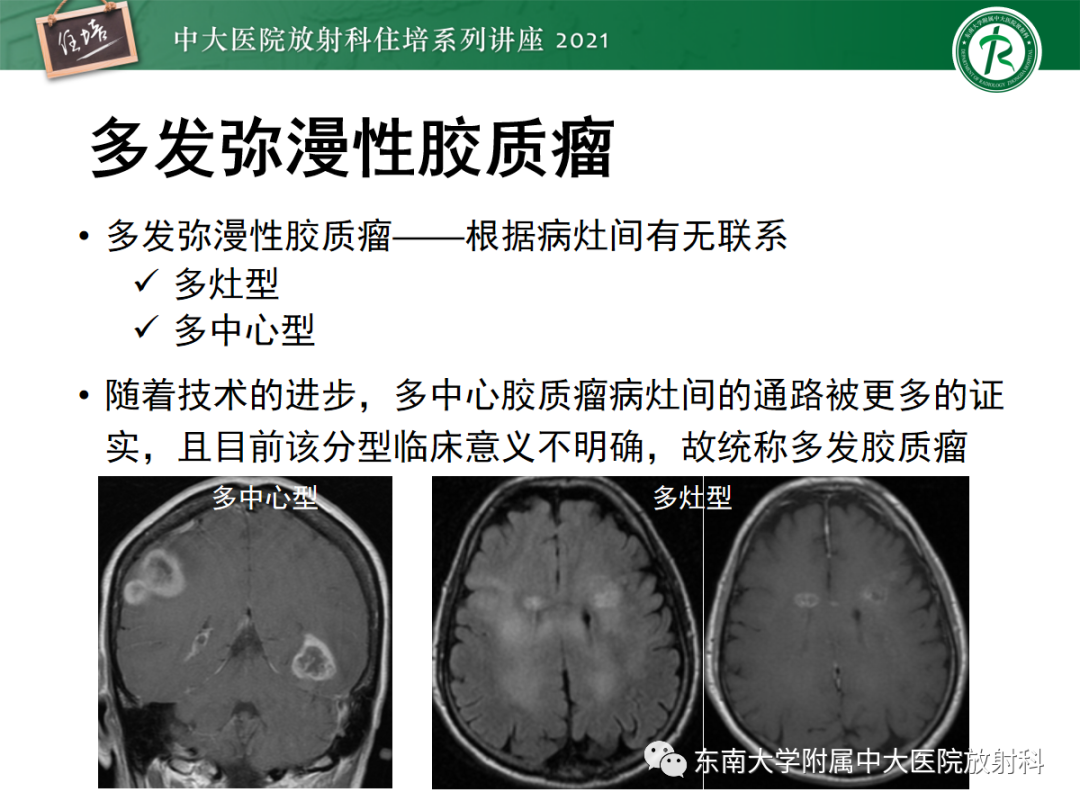 影像PPT - 【PPT】颅内多发占位的影像诊断-8