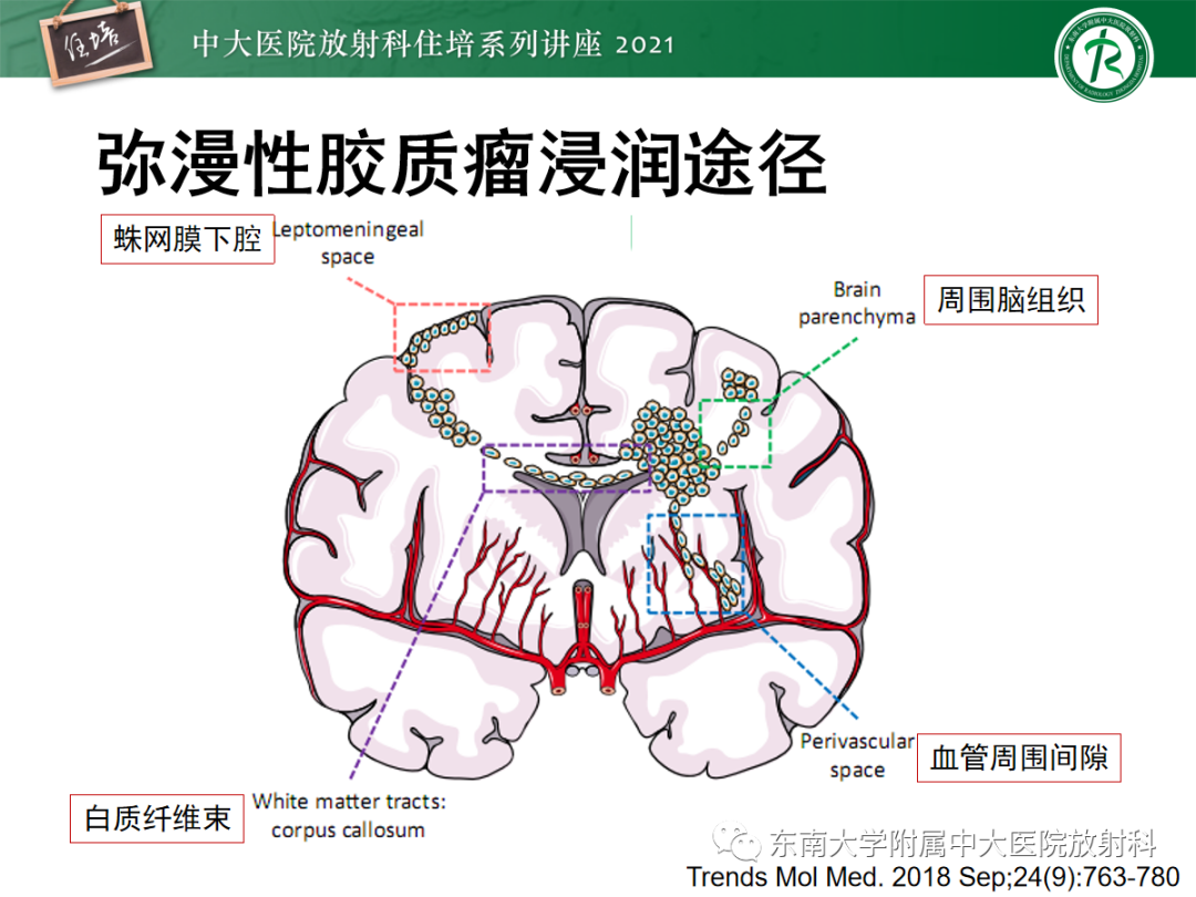 影像PPT - 【PPT】颅内多发占位的影像诊断-9