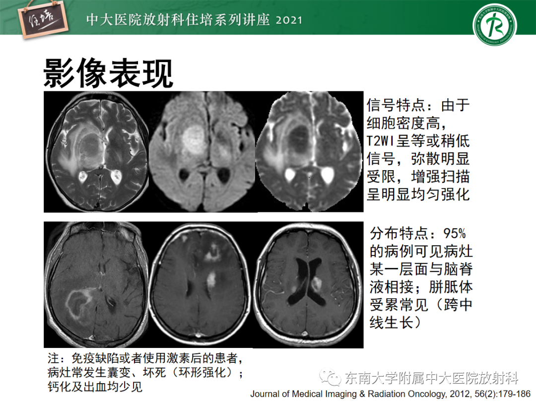 影像PPT - 【PPT】颅内多发占位的影像诊断-13