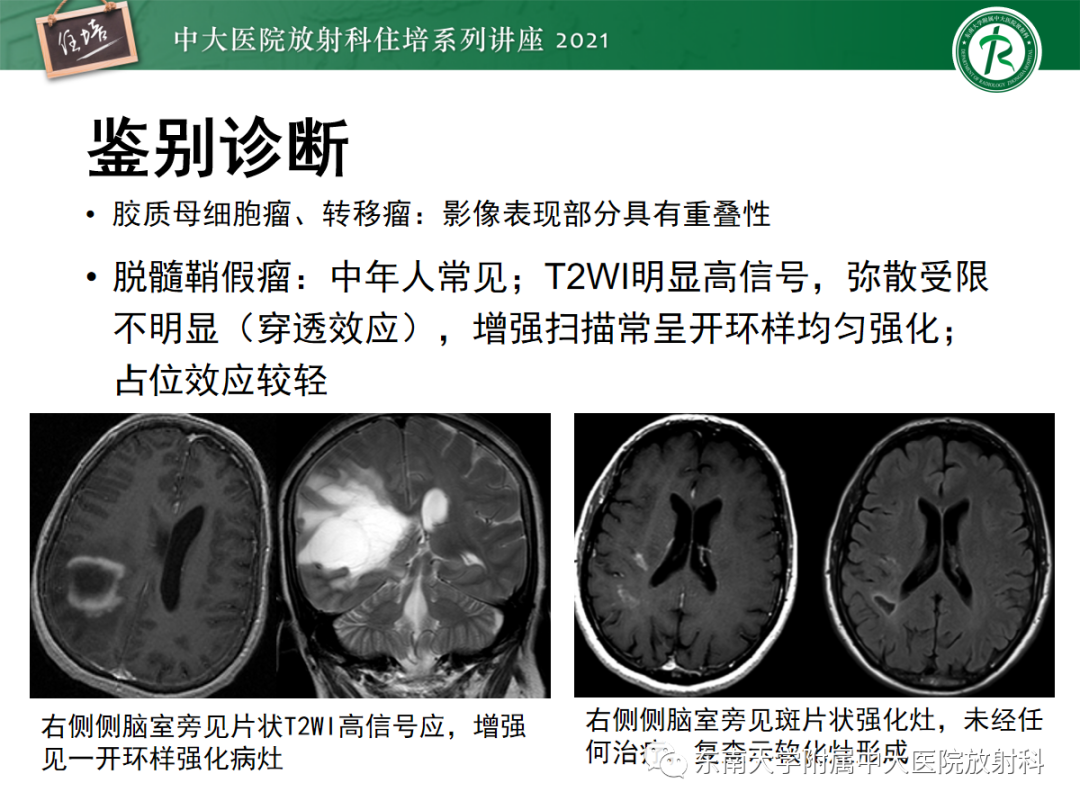 影像PPT - 【PPT】颅内多发占位的影像诊断-14