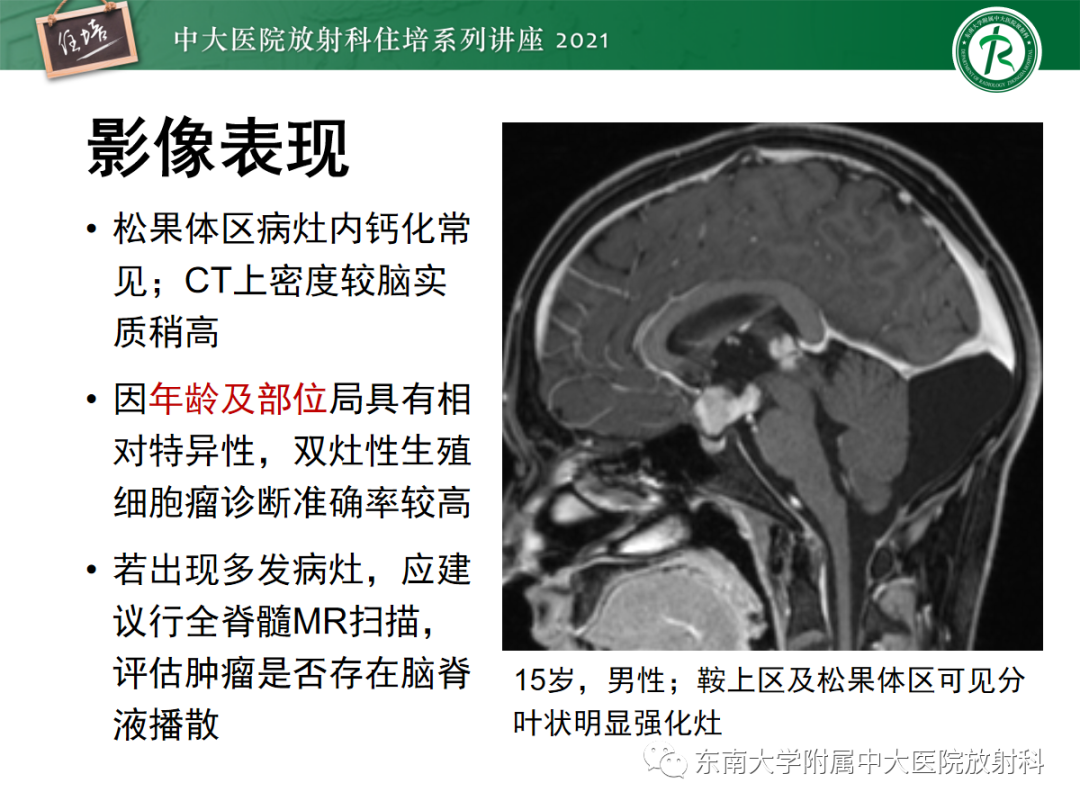 影像PPT - 【PPT】颅内多发占位的影像诊断-17