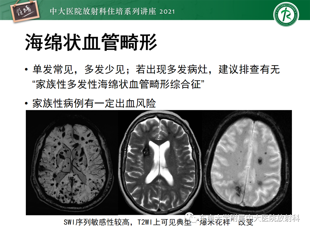 影像PPT - 【PPT】颅内多发占位的影像诊断-18