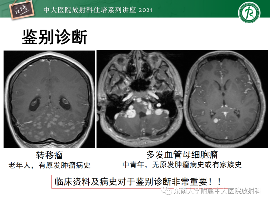 影像PPT - 【PPT】颅内多发占位的影像诊断-22