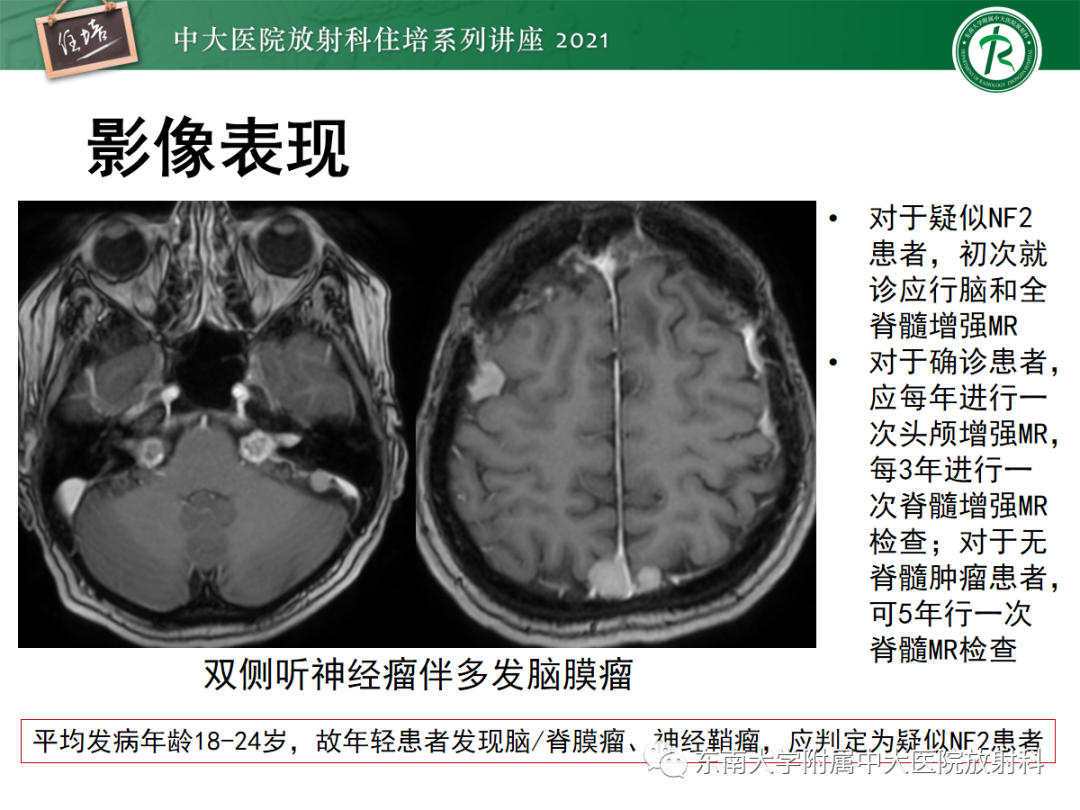 影像PPT - 【PPT】颅内多发占位的影像诊断-24