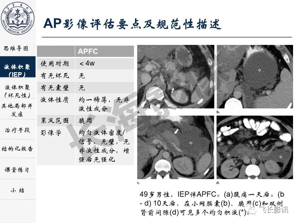 影像PPT - 【PPT】急性胰腺炎亚特兰大分级修订版解读—影像术语规范及结构化报告-11