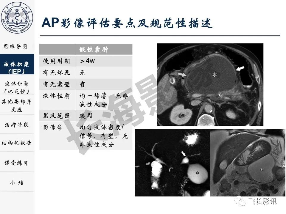 影像PPT - 【PPT】急性胰腺炎亚特兰大分级修订版解读—影像术语规范及结构化报告-12