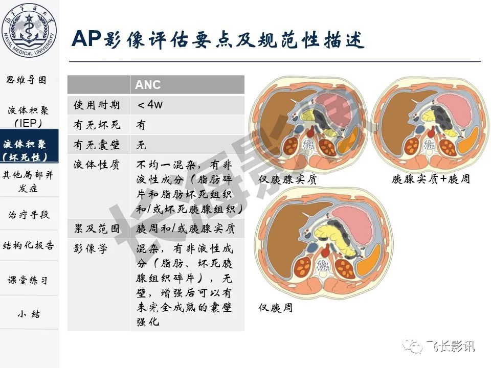 影像PPT - 【PPT】急性胰腺炎亚特兰大分级修订版解读—影像术语规范及结构化报告-13