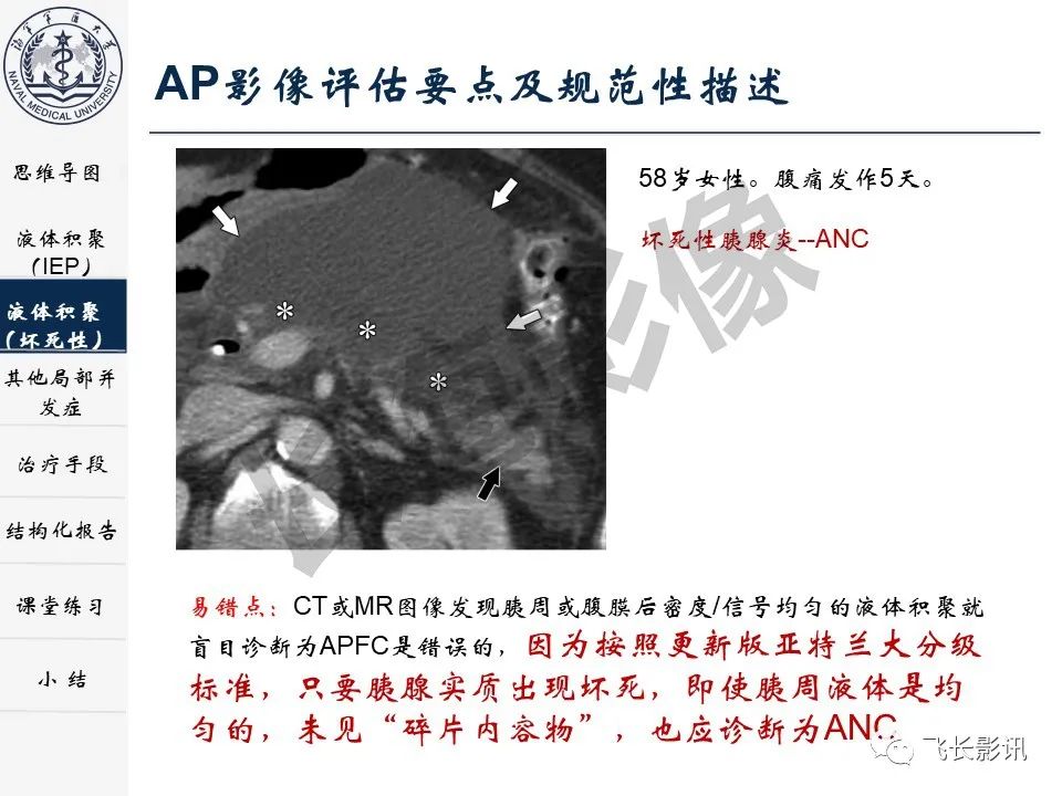 影像PPT - 【PPT】急性胰腺炎亚特兰大分级修订版解读—影像术语规范及结构化报告-16