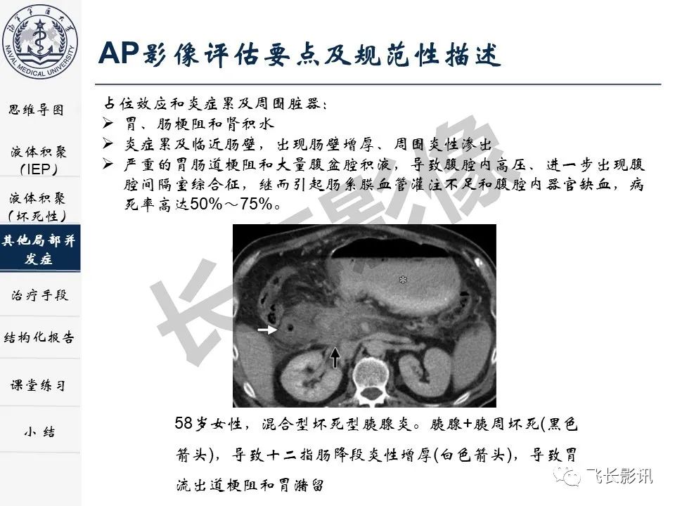 影像PPT - 【PPT】急性胰腺炎亚特兰大分级修订版解读—影像术语规范及结构化报告-23