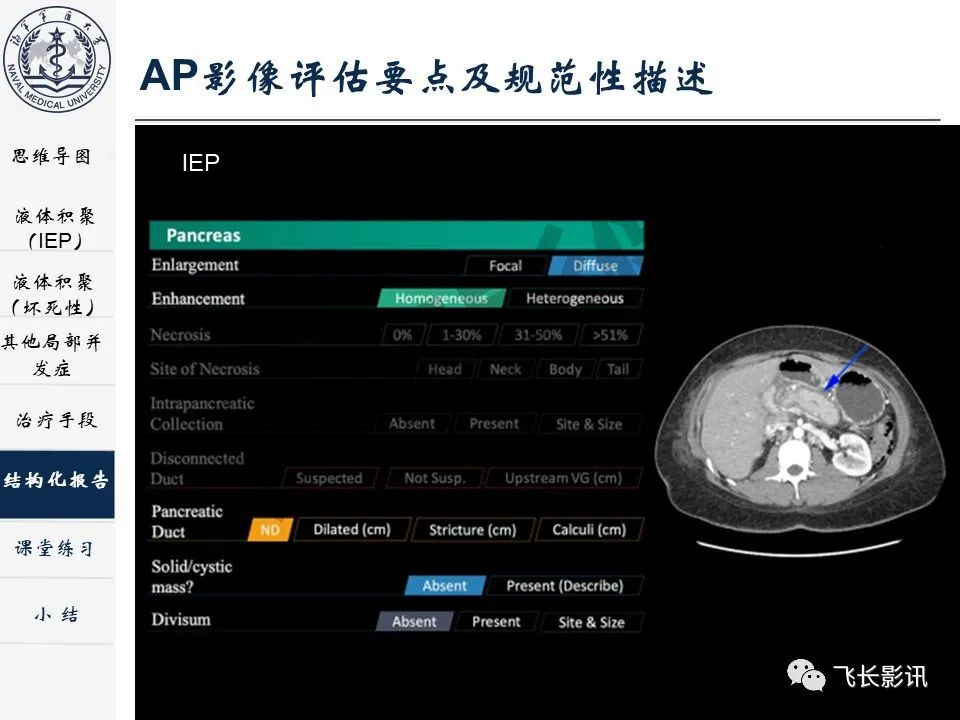 影像PPT - 【PPT】急性胰腺炎亚特兰大分级修订版解读—影像术语规范及结构化报告-29
