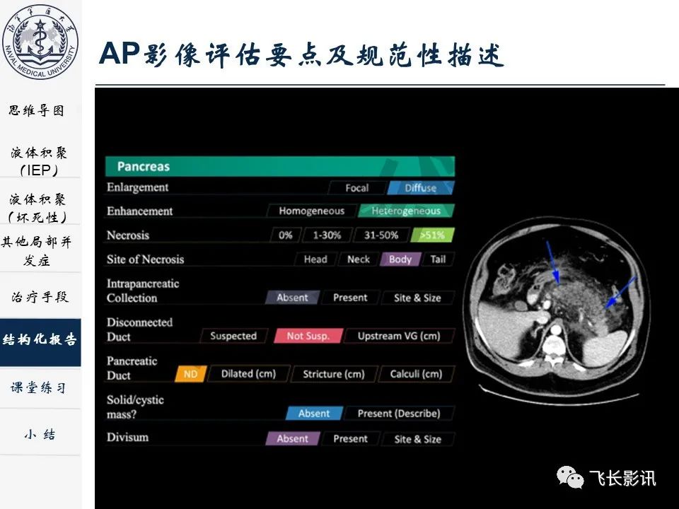 影像PPT - 【PPT】急性胰腺炎亚特兰大分级修订版解读—影像术语规范及结构化报告-30