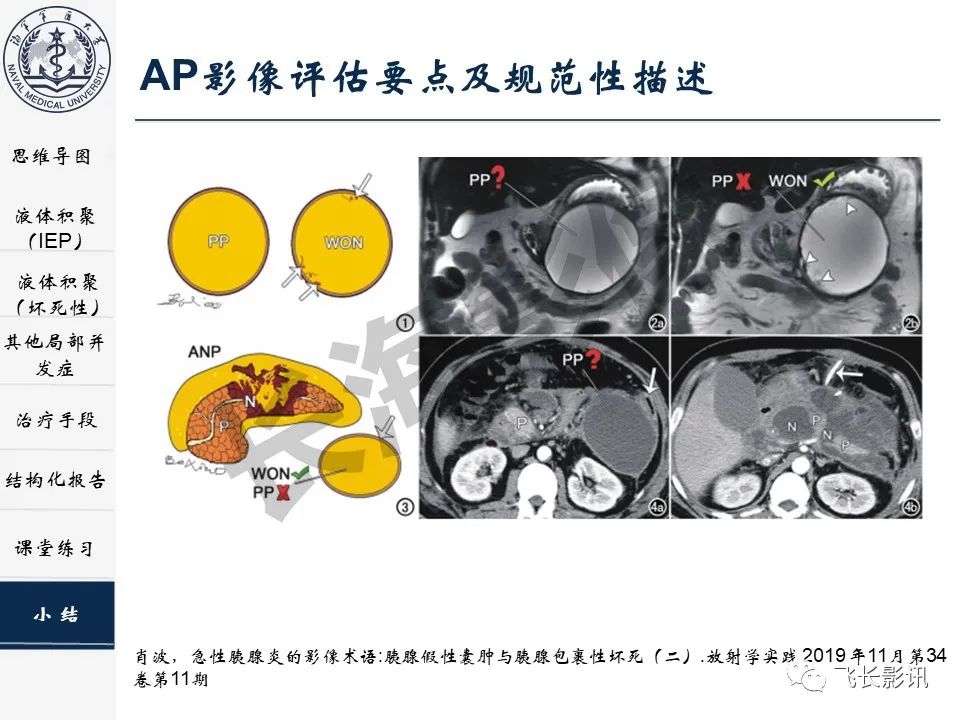 影像PPT - 【PPT】急性胰腺炎亚特兰大分级修订版解读—影像术语规范及结构化报告-1