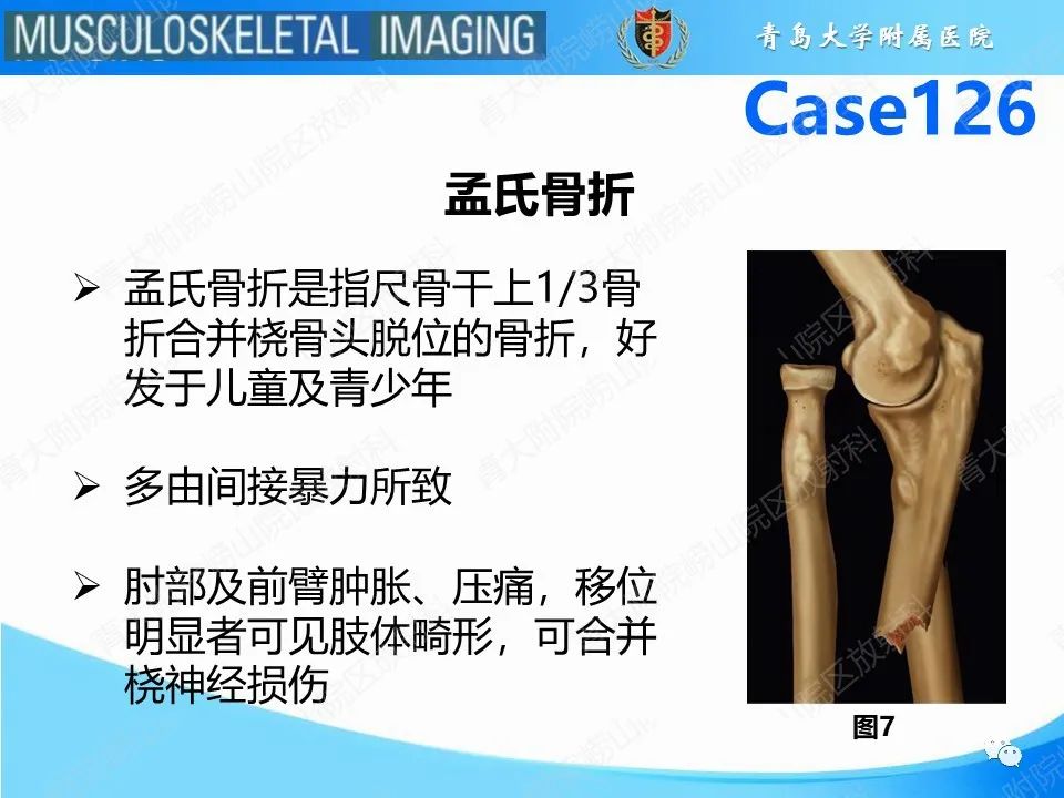影像PPT - 【PPT】孟氏骨折—脱位-8
