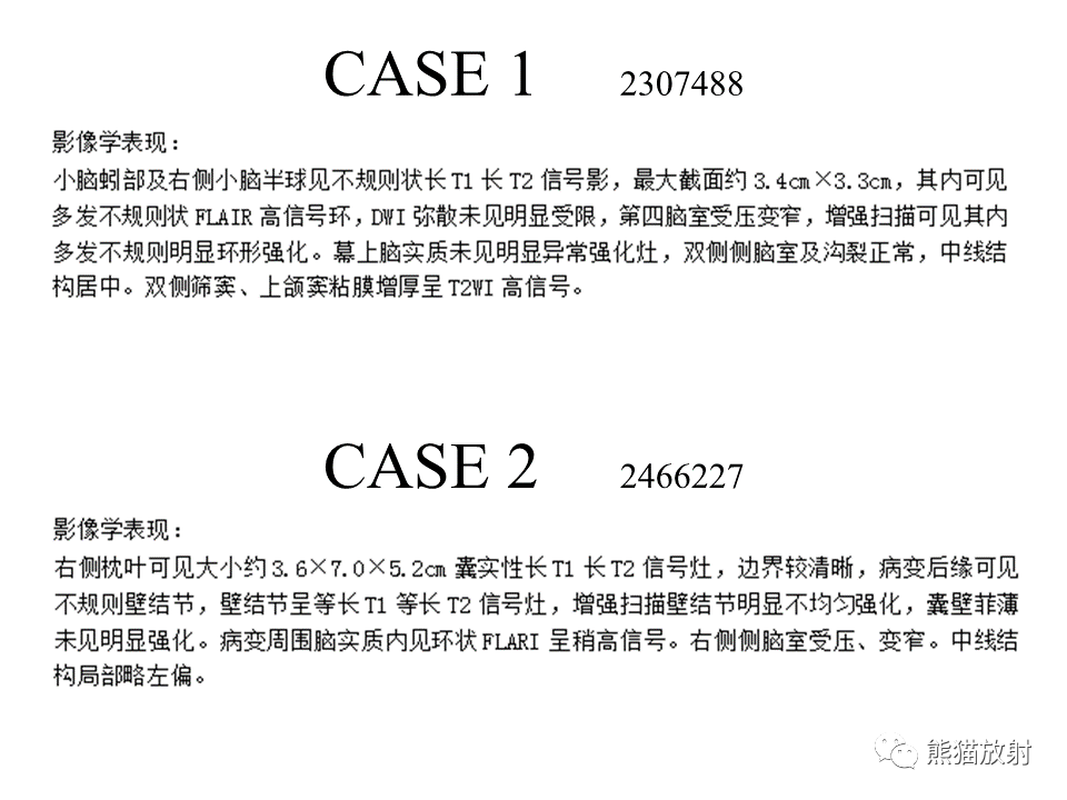 影像PPT - 【病例】伴菊形团形成的胶质神经元肿瘤 VS 乳头状胶质神经元肿瘤-15