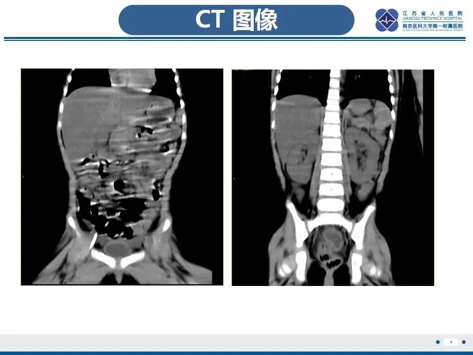 影像PPT - 【PPT】瑞氏综合征-7