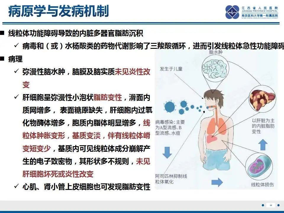 影像PPT - 【PPT】瑞氏综合征-21