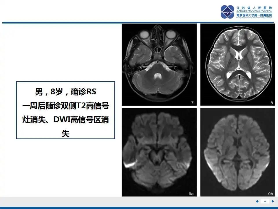 影像PPT - 【PPT】瑞氏综合征-27