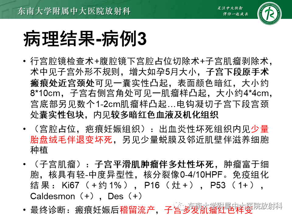 影像PPT - 【PPT】妊娠残留物的MR诊断及鉴别-9 影像PPT - 【PPT】妊娠残留物的MR诊断及鉴别-9