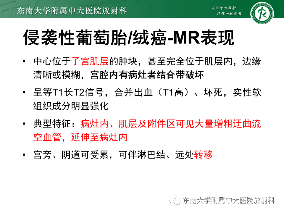 影像PPT - 【PPT】妊娠残留物的MR诊断及鉴别-24 影像PPT - 【PPT】妊娠残留物的MR诊断及鉴别-24