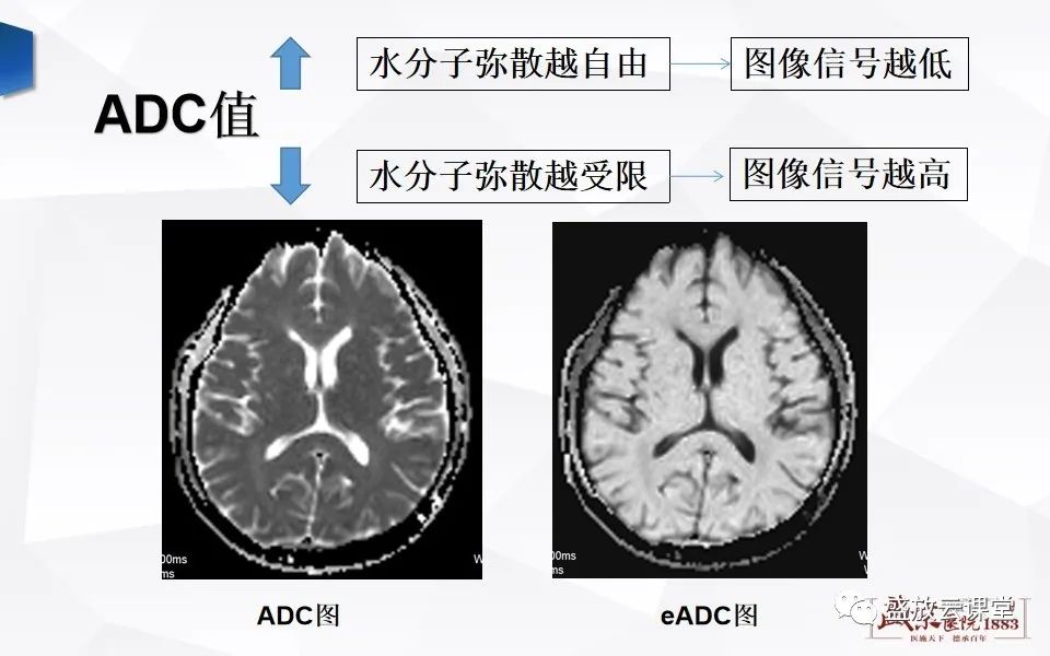 影像PPT - 【PPT】DWI成像原理及应用-5