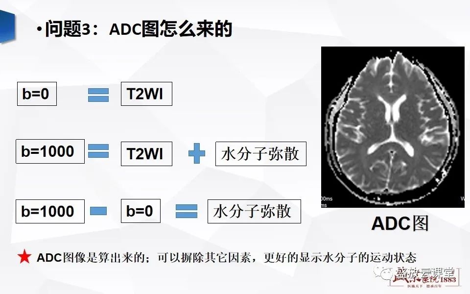 影像PPT - 【PPT】DWI成像原理及应用-4