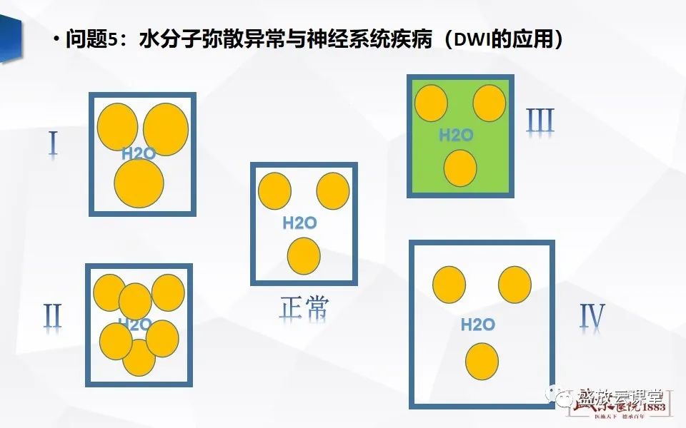 影像PPT - 【PPT】DWI成像原理及应用-10