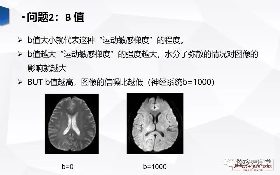影像PPT - 【PPT】DWI成像原理及应用-3