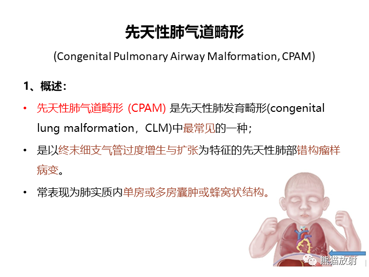 影像PPT - 【病例】先天性肺气道畸形 VS 先天性肺叶过度充气（肺气肿）-17