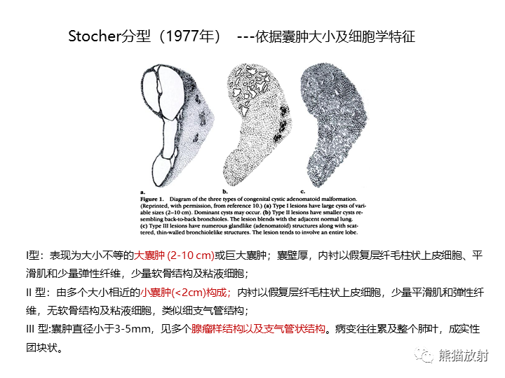 影像PPT - 【病例】先天性肺气道畸形 VS 先天性肺叶过度充气（肺气肿）-22