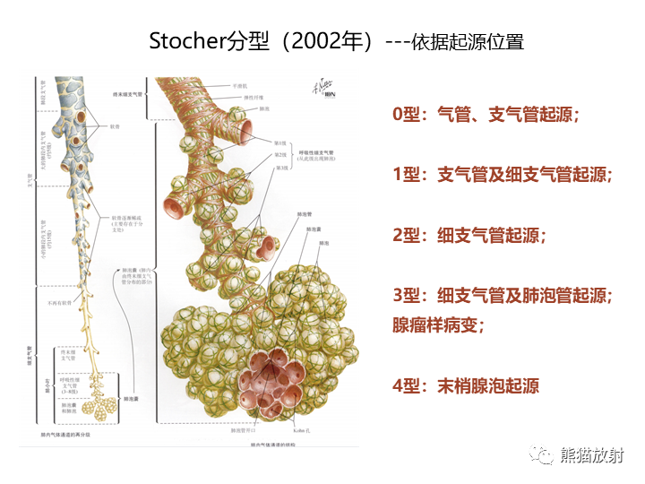影像PPT - 【病例】先天性肺气道畸形 VS 先天性肺叶过度充气（肺气肿）-23