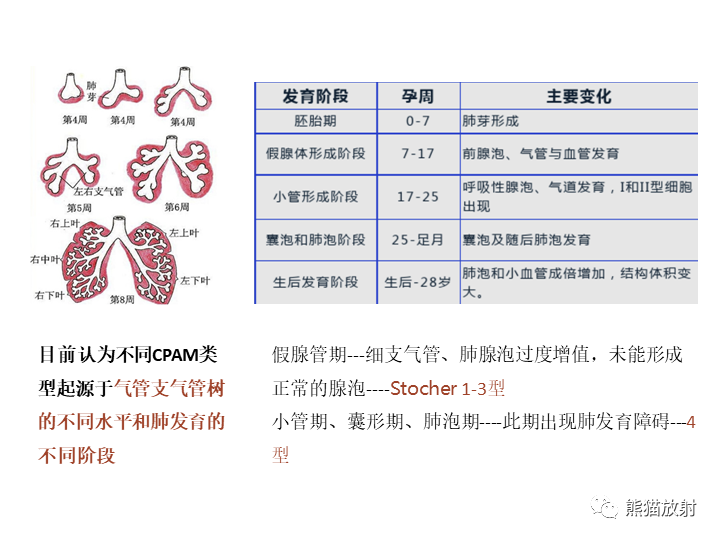 影像PPT - 【病例】先天性肺气道畸形 VS 先天性肺叶过度充气（肺气肿）-24