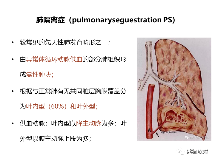 影像PPT - 【病例】先天性肺气道畸形 VS 先天性肺叶过度充气（肺气肿）-34