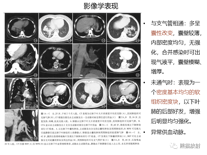 影像PPT - 【病例】先天性肺气道畸形 VS 先天性肺叶过度充气（肺气肿）-35