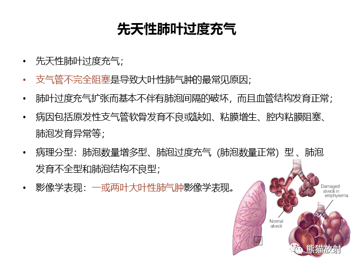 影像PPT - 【病例】先天性肺气道畸形 VS 先天性肺叶过度充气（肺气肿）-36