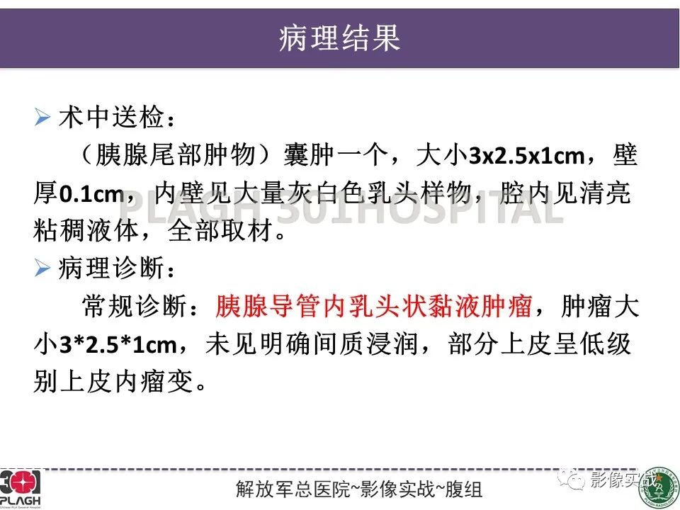 影像PPT - 【PPT】胰腺导管乳头管粘液瘤IPMN一例MR-20