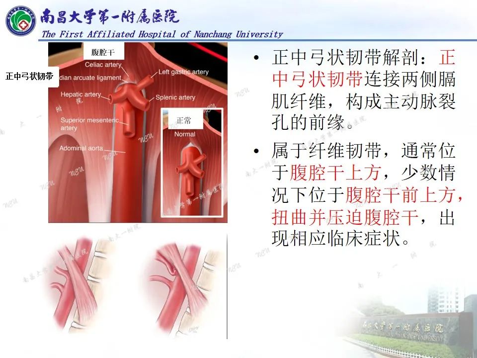 影像PPT - 【PPT】浅谈血管压迫综合征-4