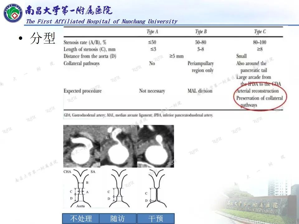影像PPT - 【PPT】浅谈血管压迫综合征-9