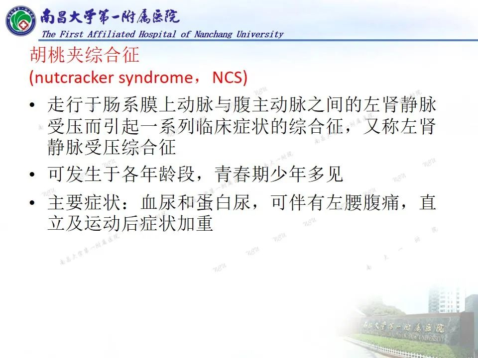 影像PPT - 【PPT】浅谈血管压迫综合征-22
