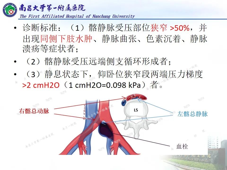 影像PPT - 【PPT】浅谈血管压迫综合征-29