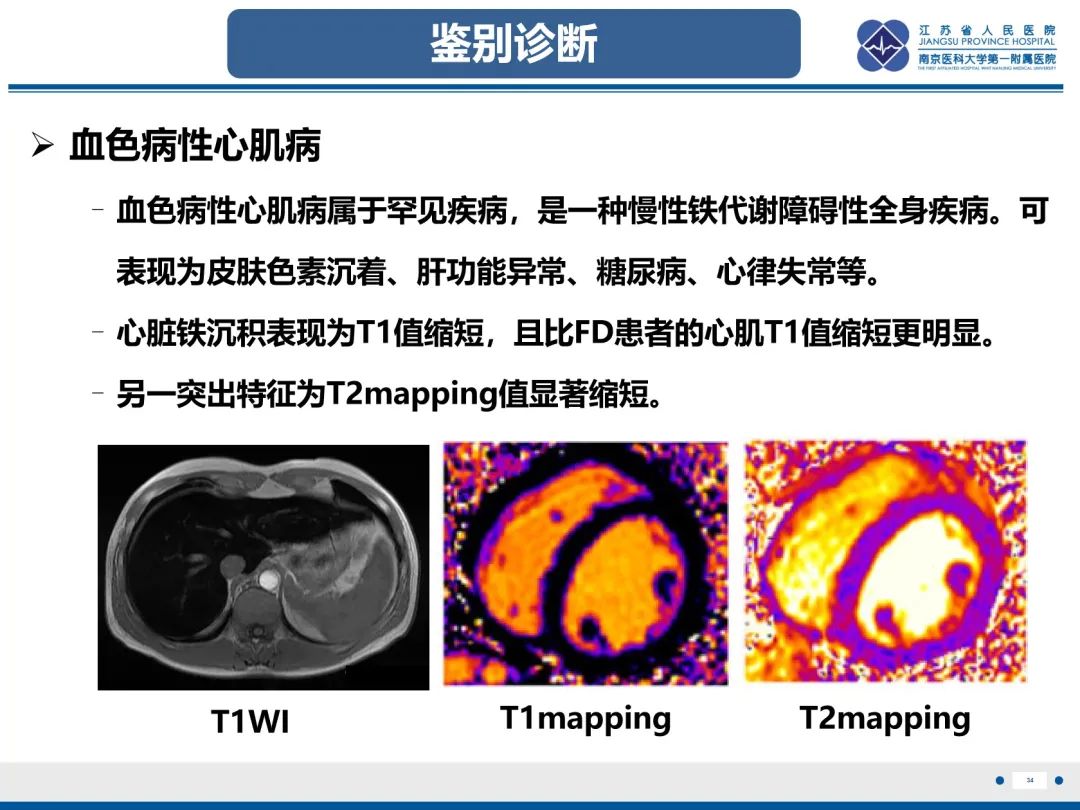 影像PPT - 【PPT】法布里病（Fabry Disease）-34