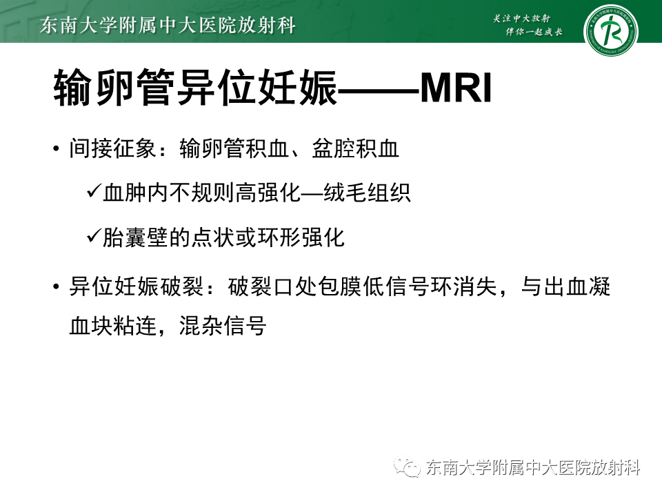影像PPT - 【PPT】异位妊娠-21 影像PPT - 【PPT】异位妊娠-21