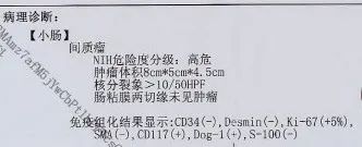 影像PPT - 小肠间质瘤影像表现-10 影像PPT - 小肠间质瘤影像表现-10
