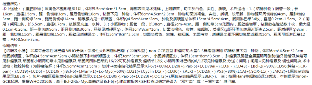 影像PPT - 小肠间质瘤影像表现-19 影像PPT - 小肠间质瘤影像表现-19